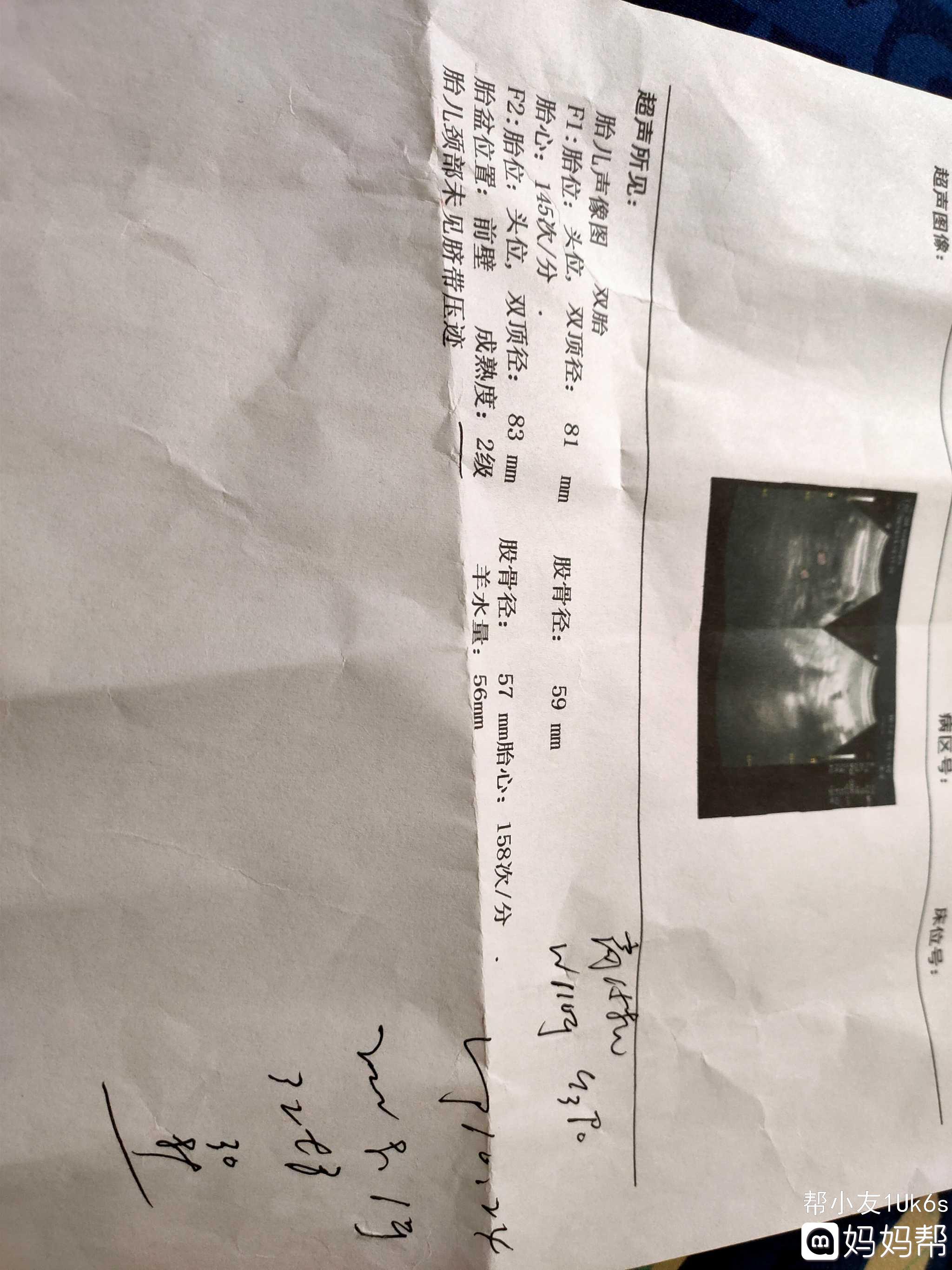 借卵做试管婴儿的速度有多快？
