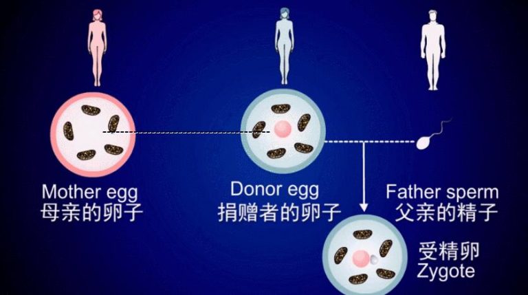 借卵试管婴儿期间我可以做什么运动？