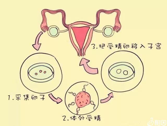 在供精助孕供卵试管期间如何补充内膜？