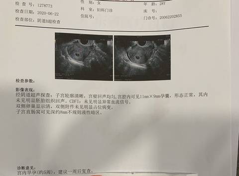 借卵做试管抗结剂方案用药怎么样使用稳定剂的作用