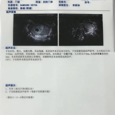 广州省妇幼第三代供卵公立代怀试管总花费要多少钱