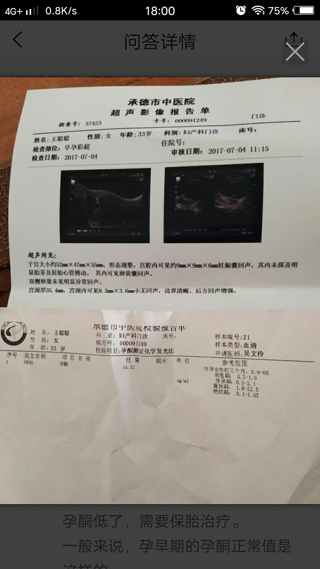 取卵的费用大概是多少