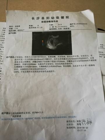 供卵试管婴儿怎么做龙凤胎