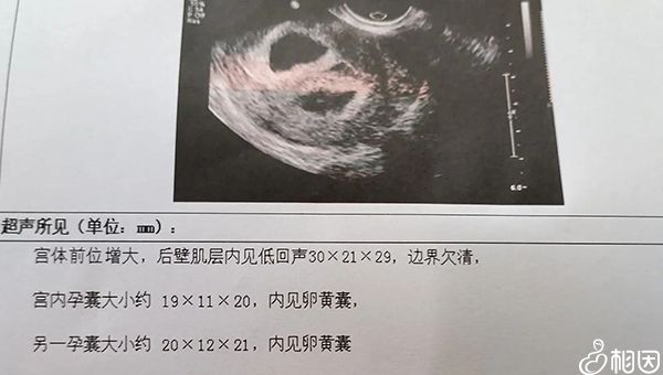 新冠供卵试管红色液体会变色吗