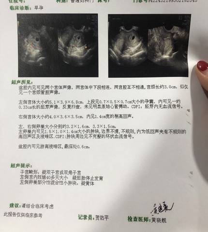 赠卵试管婴儿术前检查
