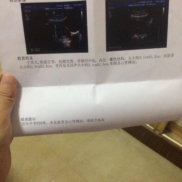 上海国际医学中心生殖中心供卵试管怎么样